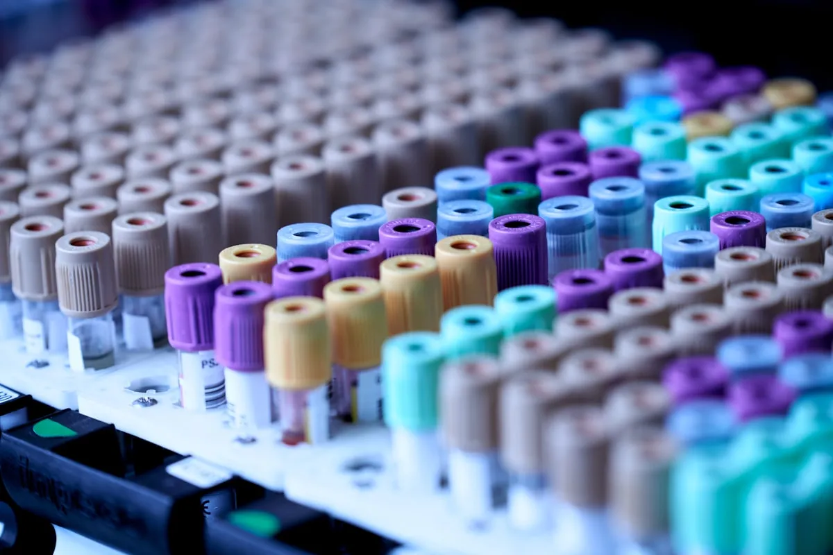 Blood collection tubes in a laboratory rack